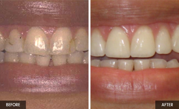 Smile-gallery2 Smile-gallery2