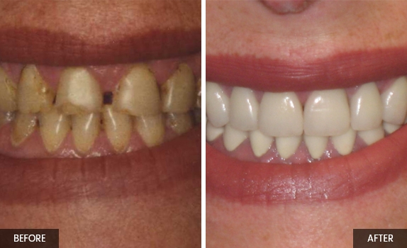 Smile-gallery4 Smile-gallery4